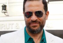 صورة الفنان المصري ماجد المصري يجري عملية جراحية دقيقة بالعين