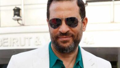 صورة الفنان المصري ماجد المصري يجري عملية جراحية دقيقة بالعين